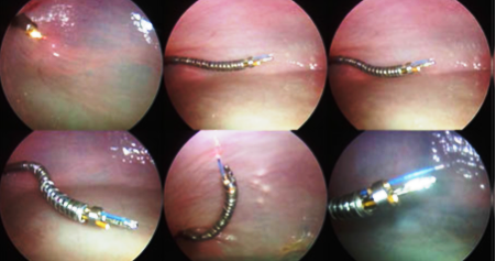 DDM in Bovine bladder