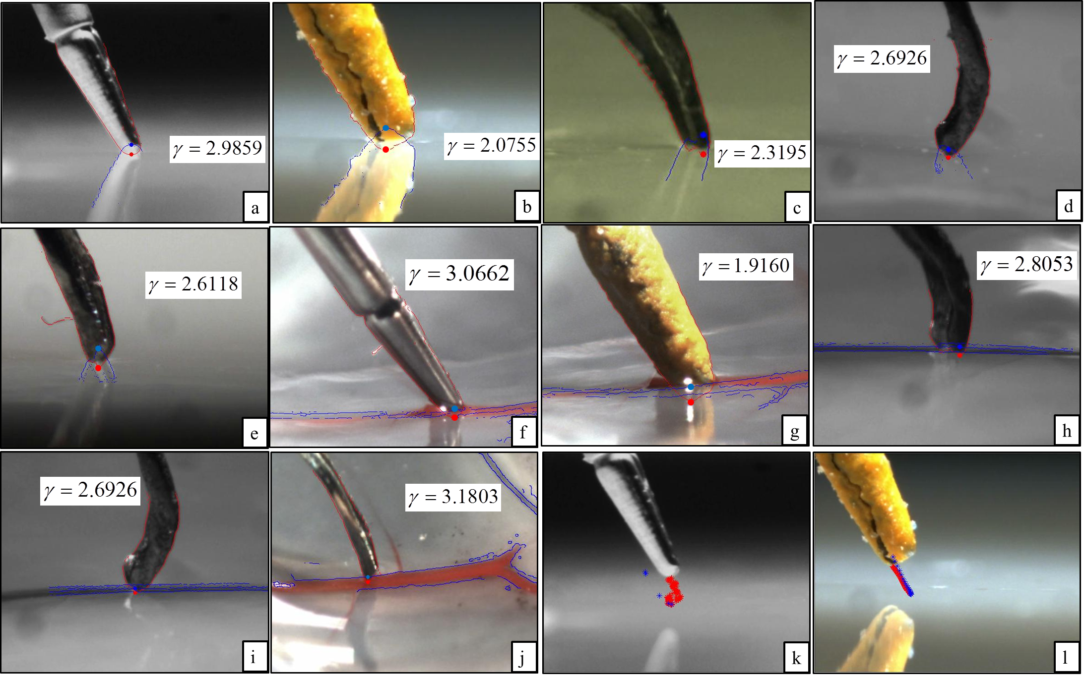 retina approach