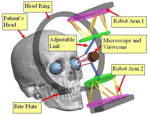 Dual arm system for ophthalmic surgery